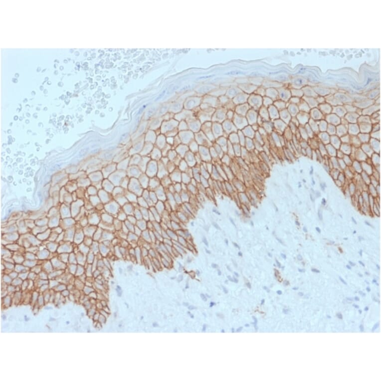Immunohistochemistry - Anti-E Cadherin Antibody [SPM471] - BSA and Azide free (A254007) - Antibodies.com