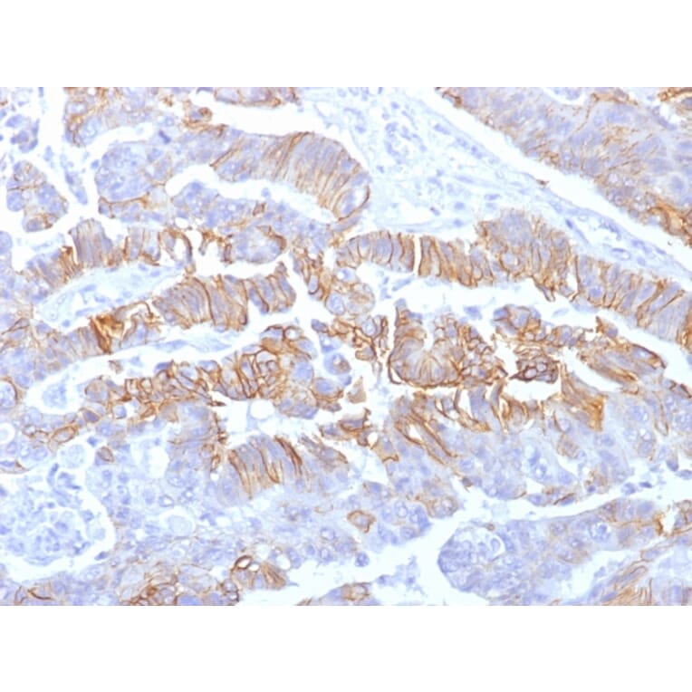Immunohistochemistry - Anti-E Cadherin Antibody [rCDH1/1525] - BSA and Azide free (A254008) - Antibodies.com