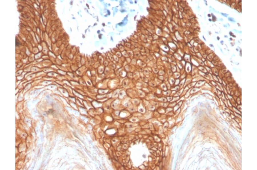 Immunohistochemistry - Anti-E Cadherin Antibody [CDH1/4398R] - BSA and Azide free (A254009) - Antibodies.com