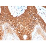 Immunohistochemistry - Anti-E Cadherin Antibody [CDH1/4398R] - BSA and Azide free (A254009) - Antibodies.com