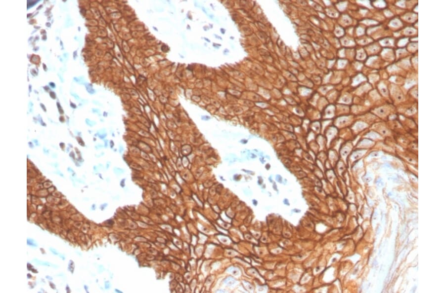 Immunohistochemistry - Anti-E Cadherin Antibody [CDH1/4398R] - BSA and Azide free (A254009) - Antibodies.com