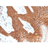 Immunohistochemistry - Anti-E Cadherin Antibody [CDH1/4398R] - BSA and Azide free (A254009) - Antibodies.com