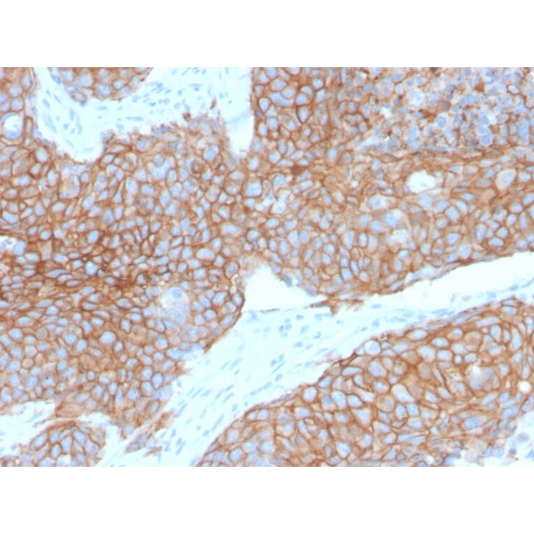 Immunohistochemistry - Anti-E Cadherin Antibody [CDH1/2208R] - BSA and Azide free (A254010) - Antibodies.com