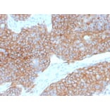 Immunohistochemistry - Anti-E Cadherin Antibody [CDH1/2208R] - BSA and Azide free (A254010) - Antibodies.com
