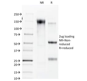 SDS-PAGE - Anti-Connexin 32 Antibody [R5.21C] - BSA and Azide free (A254012) - Antibodies.com