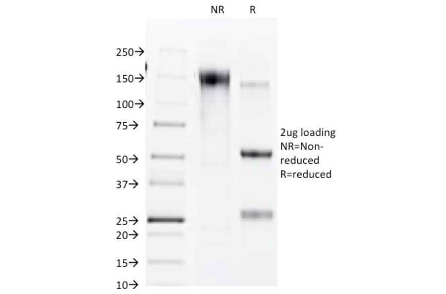 SDS-PAGE - Anti-Connexin 32 Antibody [R5.21C] - BSA and Azide free (A254012) - Antibodies.com
