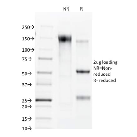 SDS-PAGE - Anti-Connexin 32 Antibody [R5.21C] - BSA and Azide free (A254012) - Antibodies.com