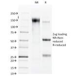 SDS-PAGE - Anti-Connexin 32 Antibody [R5.21C] - BSA and Azide free (A254012) - Antibodies.com