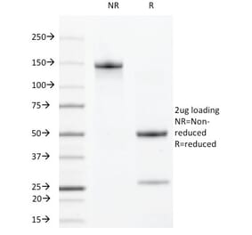SDS-PAGE - Anti-VEGF Receptor 2 Antibody [DC101] - BSA and Azide free (A254013) - Antibodies.com