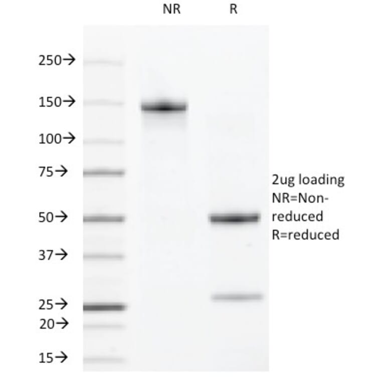 SDS-PAGE - Anti-VEGF Receptor 2 Antibody [DC101] - BSA and Azide free (A254013) - Antibodies.com