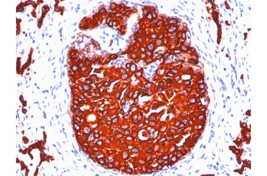 Immunohistochemistry - Anti-pan Cytokeratin Antibody [KRTL/1077 + KRTH/1076] - BSA and Azide free (A254017) - Antibodies.com