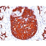 Immunohistochemistry - Anti-pan Cytokeratin Antibody [KRTL/1077 + KRTH/1076] - BSA and Azide free (A254017) - Antibodies.com