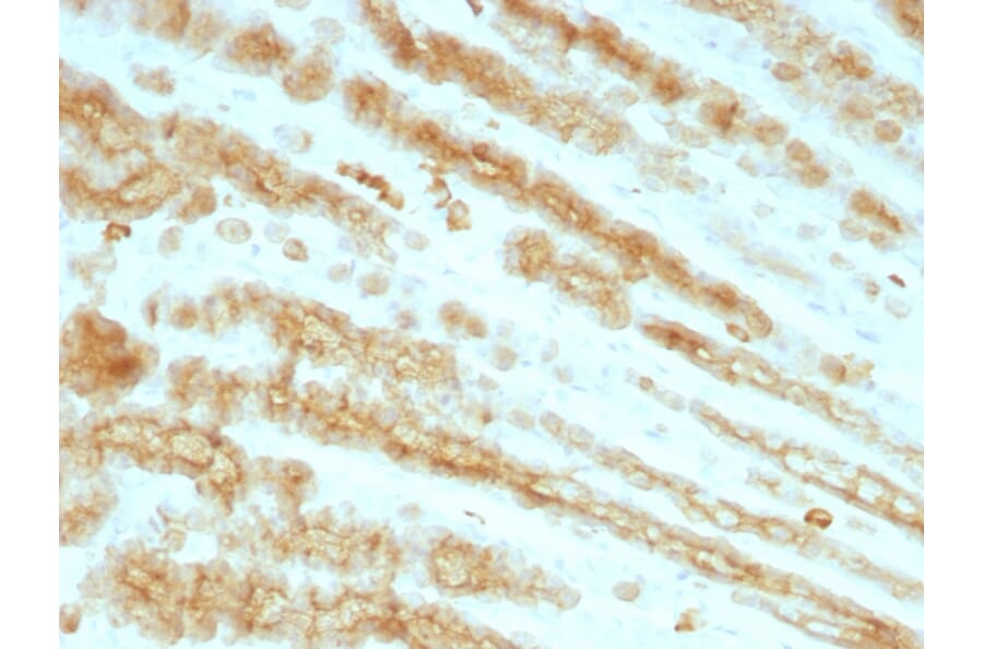 Immunohistochemistry - Anti-pan Cytokeratin Antibody [KRTL/1077 + KRTH/1076] - BSA and Azide free (A254019) - Antibodies.com