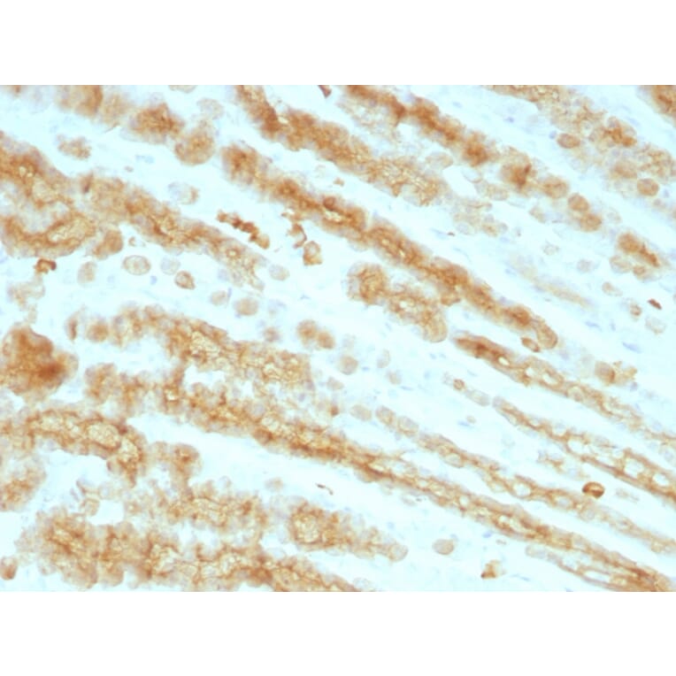 Immunohistochemistry - Anti-pan Cytokeratin Antibody [KRTL/1077 + KRTH/1076] - BSA and Azide free (A254019) - Antibodies.com