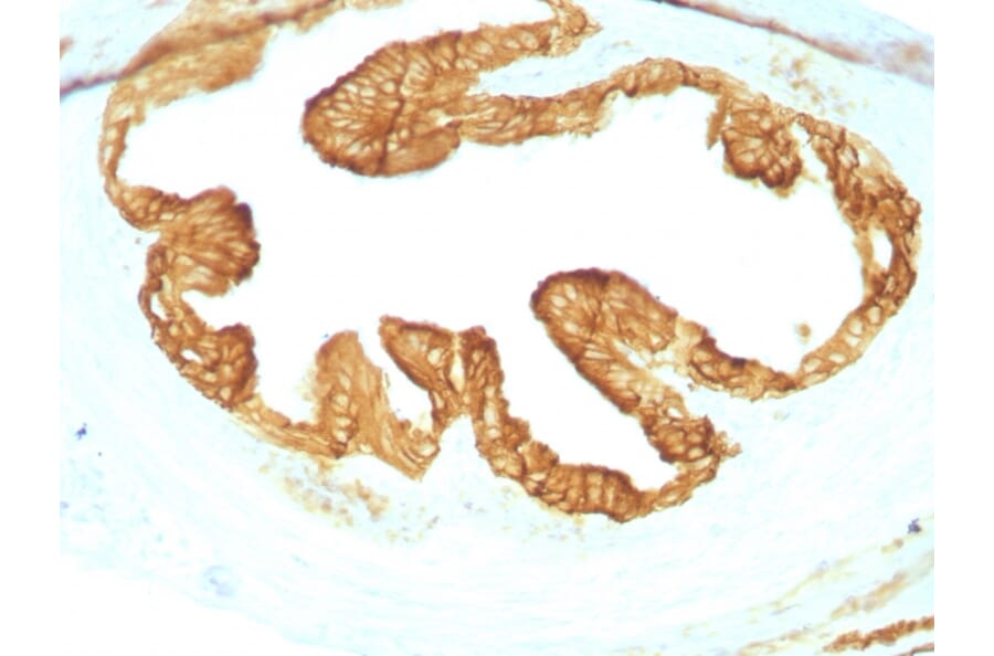 Immunohistochemistry - Anti-pan Cytokeratin Antibody [KRTL/1077 + KRTH/1076] - BSA and Azide free (A254019) - Antibodies.com
