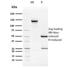 SDS-PAGE - Anti-HPV16 E2 Antibody [TVG 261] - BSA and Azide free (A254019) - Antibodies.com