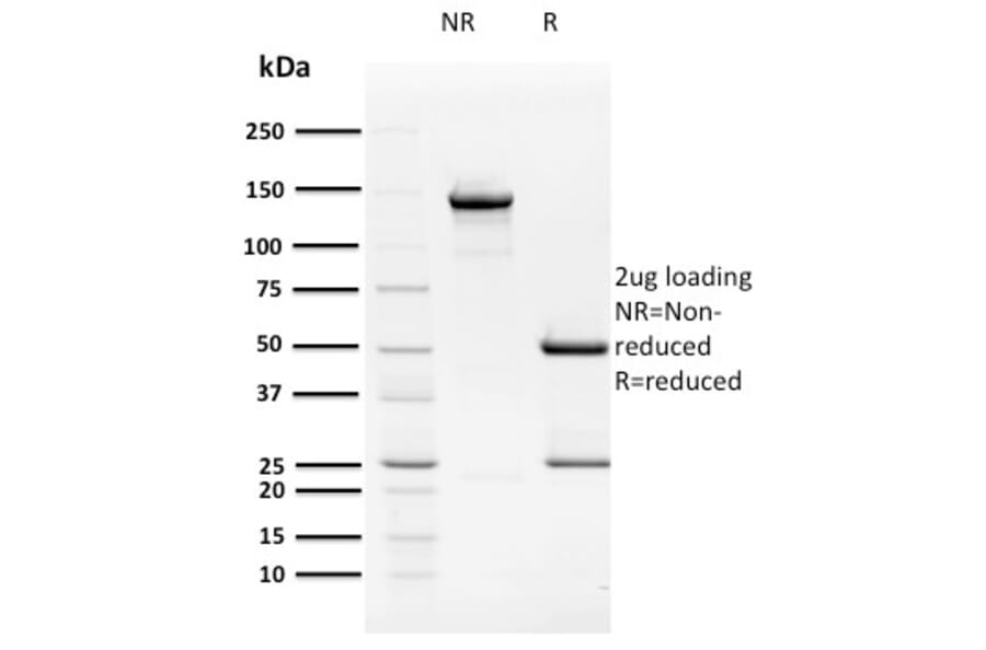 SDS-PAGE - Anti-HPV16 E2 Antibody [TVG 261] - BSA and Azide free (A254019) - Antibodies.com
