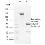 SDS-PAGE - Anti-HPV16 E2 Antibody [TVG 261] - BSA and Azide free (A254019) - Antibodies.com