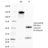 SDS-PAGE - Anti-Cytomegalovirus p65 Antibody [CMV100] - BSA and Azide free (A254020) - Antibodies.com