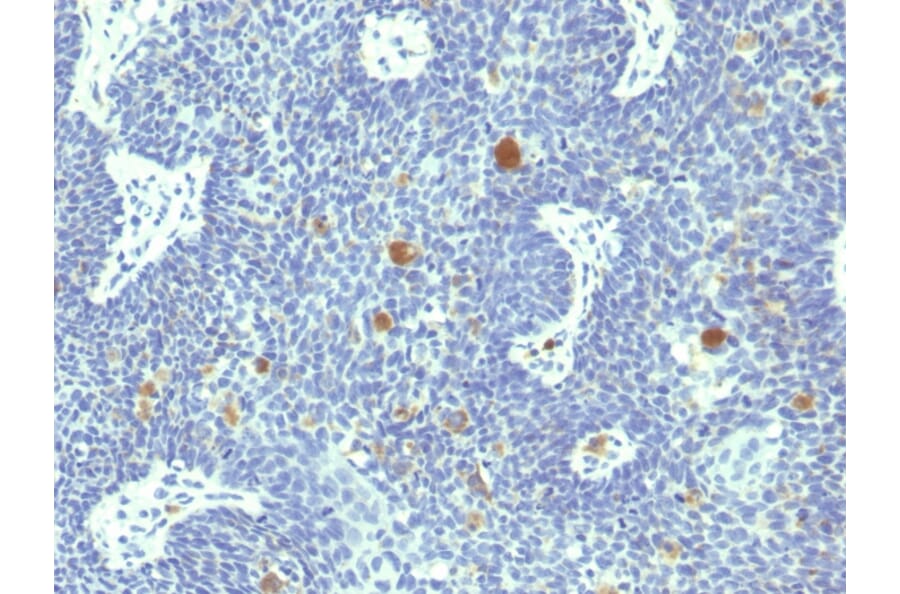Immunohistochemistry - Anti-HPV-18 Antibody [HPV18/1297] - BSA and Azide free (A254025) - Antibodies.com