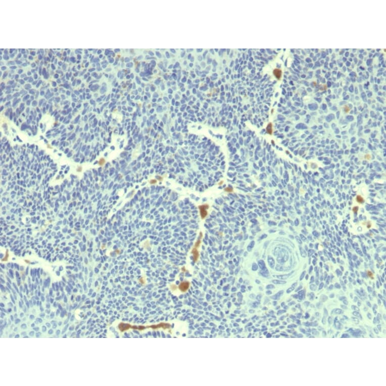 Immunohistochemistry - Anti-HPV-18 Antibody [HPV18/1297] - BSA and Azide free (A254024) - Antibodies.com