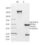 SDS-PAGE - Anti-Borrelia burgdorferi p41 Flagellin Antibody [6802] - BSA and Azide free (A254026) - Antibodies.com