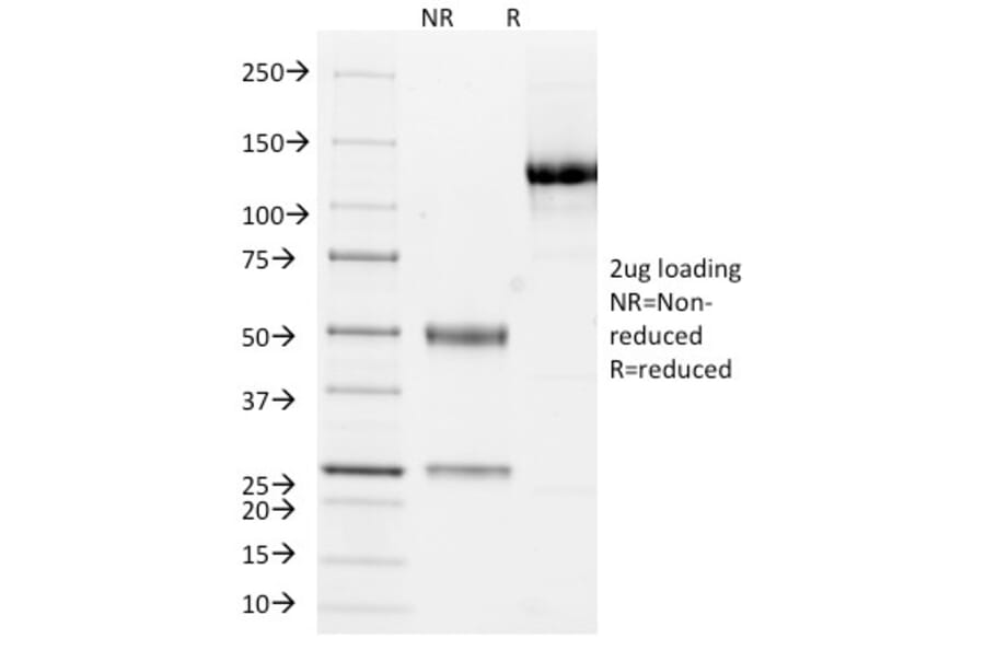 SDS-PAGE - Anti-Cytokeratin 10 + 13 Antibody [DE-K13] - BSA and Azide free (A254030) - Antibodies.com