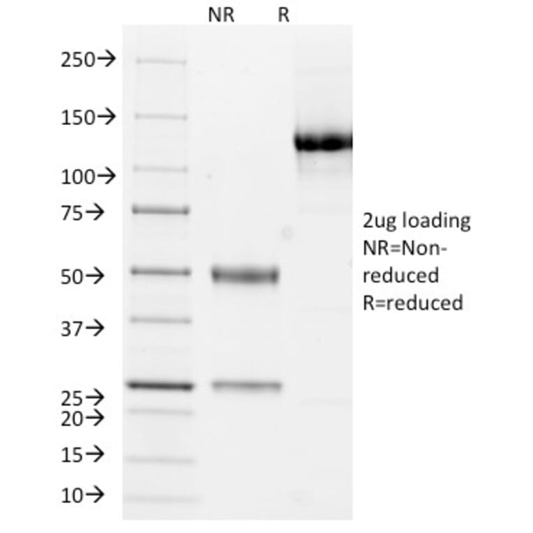 SDS-PAGE - Anti-Cytokeratin 10 + 13 Antibody [DE-K13] - BSA and Azide free (A254030) - Antibodies.com