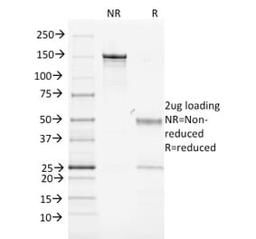 SDS-PAGE - Anti-MHC Class II Antibody [MK-D6] - BSA and Azide free (A254031) - Antibodies.com