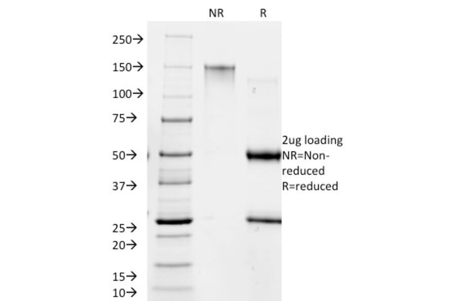 SDS-PAGE - Anti-Giardia lamblia Antibody [BB1.1E5] - BSA and Azide free (A254033) - Antibodies.com