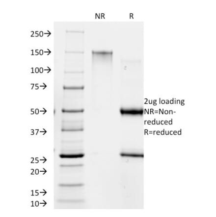 SDS-PAGE - Anti-Giardia lamblia Antibody [BB1.1E5] - BSA and Azide free (A254033) - Antibodies.com