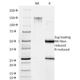 SDS-PAGE - Anti-Giardia lamblia Antibody [BB1.1E5] - BSA and Azide free (A254033) - Antibodies.com