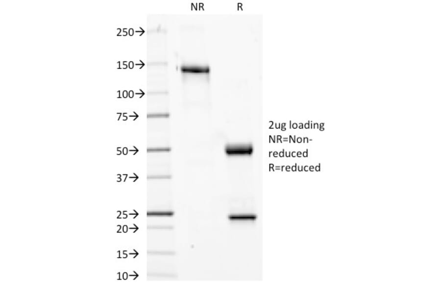 SDS-PAGE - Anti-Phosphotyrosine Antibody [PY20] - BSA and Azide free (A254038) - Antibodies.com