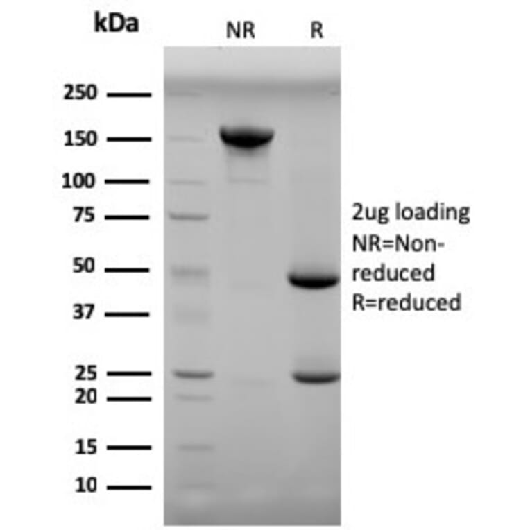 SDS-PAGE - Anti-Progesterone Antibody [6-5E-3F] - BSA and Azide free (A254038) - Antibodies.com