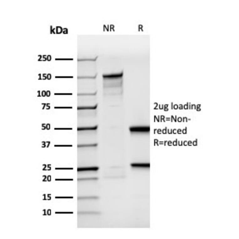 SDS-PAGE - Anti-BrdU Antibody [rBRD494] - BSA and Azide free (A254039) - Antibodies.com