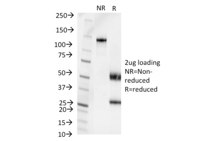 SDS-PAGE - Anti-Pseudomonas aeruginosa Serotype 6C Antibody [1200/472] - BSA and Azide free (A254040) - Antibodies.com