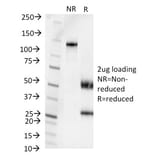 SDS-PAGE - Anti-Pseudomonas aeruginosa Serotype 6C Antibody [1200/472] - BSA and Azide free (A254040) - Antibodies.com
