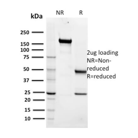 SDS-PAGE - Anti-Maltose Binding Protein Antibody [R29.6] - BSA and Azide free (A254043) - Antibodies.com