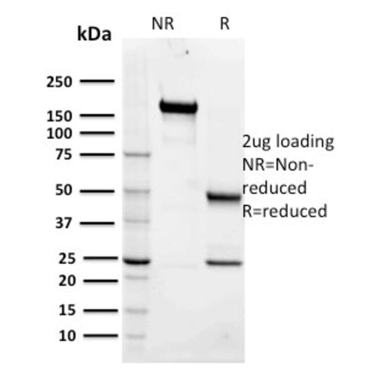 SDS-PAGE - Anti-Maltose Binding Protein Antibody [R29.6] - BSA and Azide free (A254043) - Antibodies.com