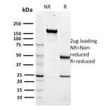 SDS-PAGE - Anti-Maltose Binding Protein Antibody [R29.6] - BSA and Azide free (A254043) - Antibodies.com