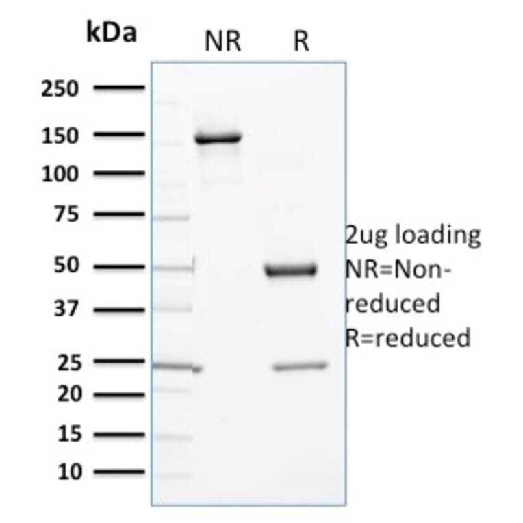 SDS-PAGE - Anti-Cytochrome P450 3A1 Antibody [P6] - BSA and Azide free (A254046) - Antibodies.com
