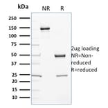 SDS-PAGE - Anti-Cytochrome P450 3A1 Antibody [P6] - BSA and Azide free (A254046) - Antibodies.com
