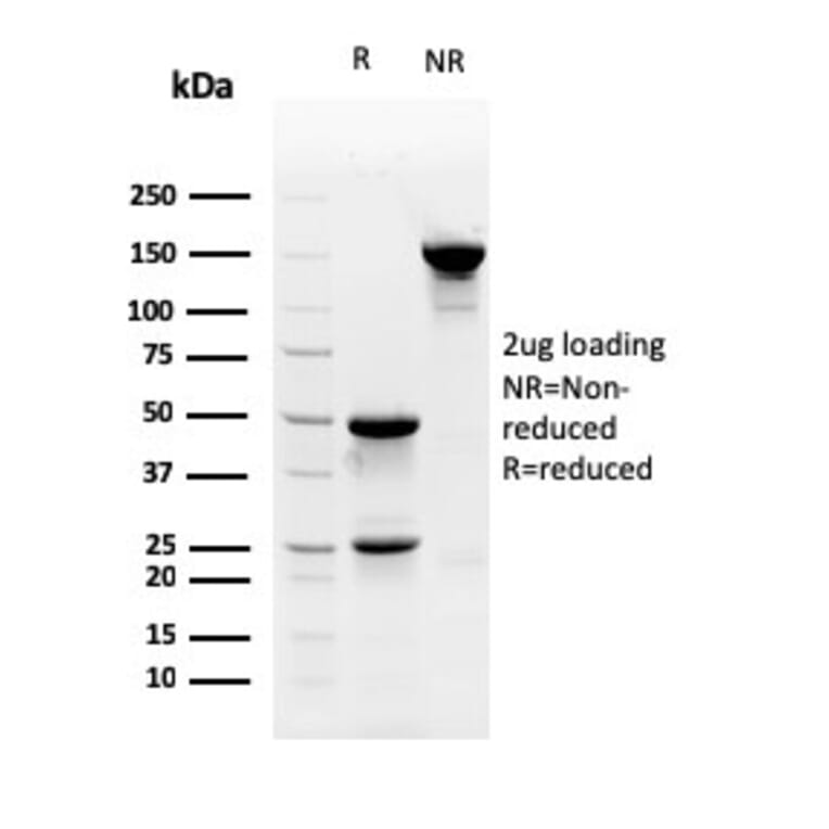 SDS-PAGE - Anti-Myofibroblast Antibody [PR 2D3] - BSA and Azide free (A254047) - Antibodies.com