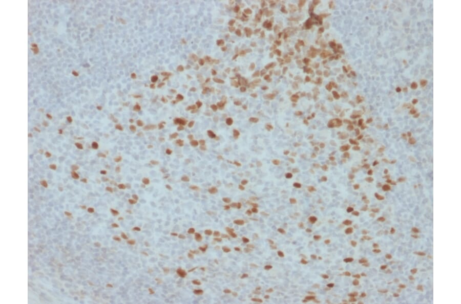 Immunohistochemistry - Anti-Proliferation Antibody [JC1] - BSA and Azide free (A254050) - Antibodies.com