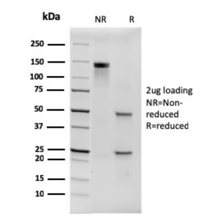 SDS-PAGE - Anti-His Tag Antibody [6HIS/3550] - BSA and Azide free (A254051) - Antibodies.com