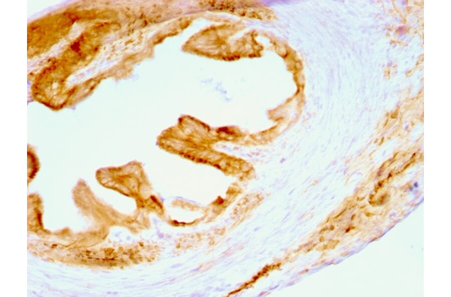 Immunohistochemistry - Anti-pan Cytokeratin Antibody [C11] - BSA and Azide free (A254053) - Antibodies.com