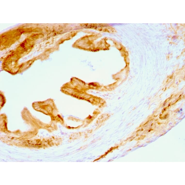 Immunohistochemistry - Anti-pan Cytokeratin Antibody [C11] - BSA and Azide free (A254053) - Antibodies.com