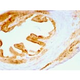 Immunohistochemistry - Anti-pan Cytokeratin Antibody [C11] - BSA and Azide free (A254053) - Antibodies.com
