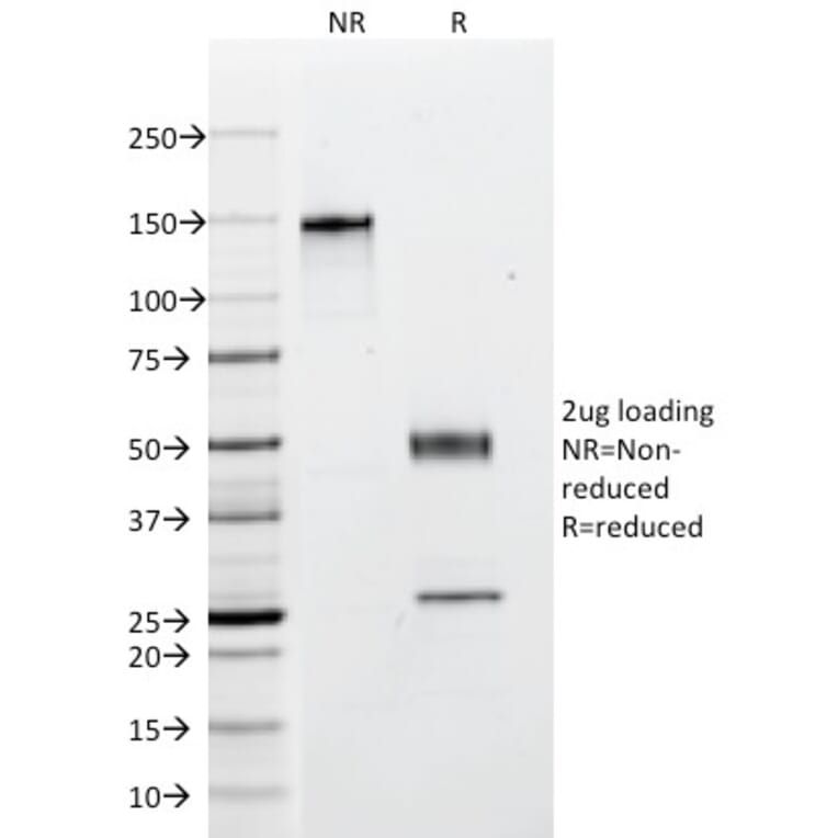 SDS-PAGE - Anti-pan Cytokeratin Antibody [C11] - BSA and Azide free (A254053) - Antibodies.com