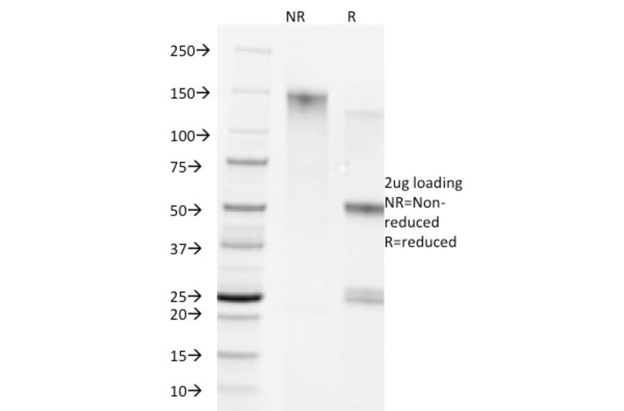 SDS-PAGE - Anti-Cytokeratin 5 + 8 Antibody [C-50] - BSA and Azide free (A254054) - Antibodies.com